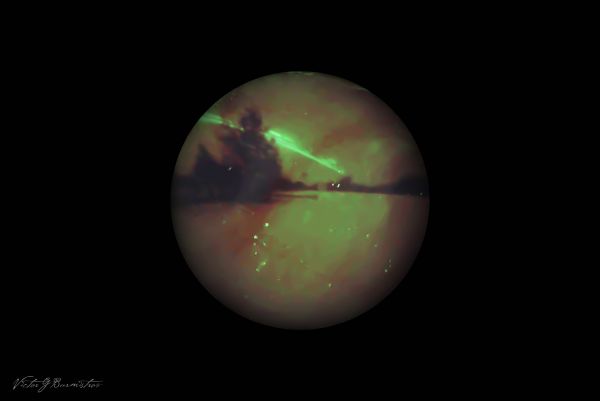 The second photo taken with a pinhole camera. - Astrophotography